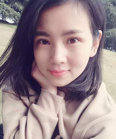 北京八大處辛敏強(qiáng)做雙眼皮怎么樣 案例分享