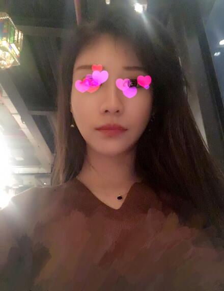 北京磨下頜角整形的果圖