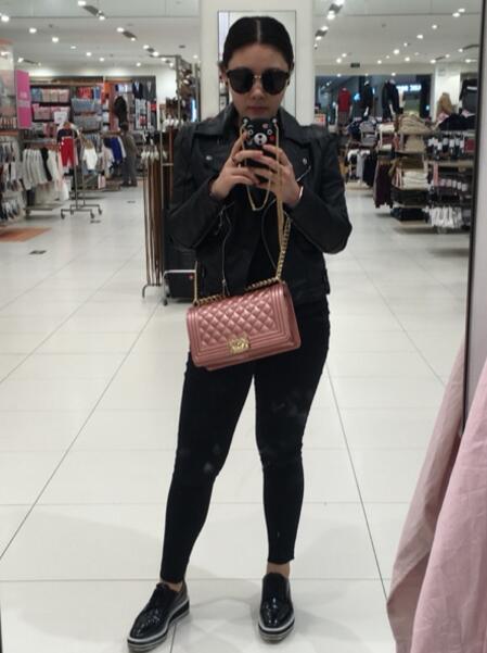 水動(dòng)力吸脂減肥瘦大腿手術(shù)前后對比圖和恢復(fù)過程