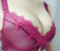 自體脂肪隆胸果很好 隆胸對比圖和恢復(fù)過程 時光整形醫(yī)院