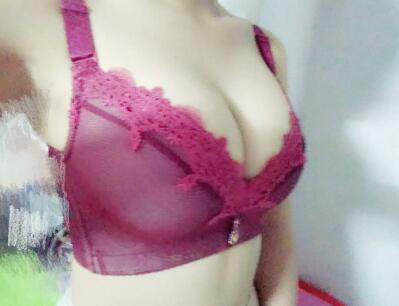 自體脂肪隆胸果很好 隆胸對(duì)比圖和恢復(fù)過(guò)程