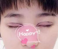 時(shí)光整形醫(yī)院做的割雙眼皮手術(shù)價(jià)格5200元 雙眼皮對比圖恢復(fù)過程