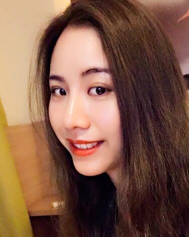 北京藝星王英勇隆鼻案例 隆鼻整形三個月