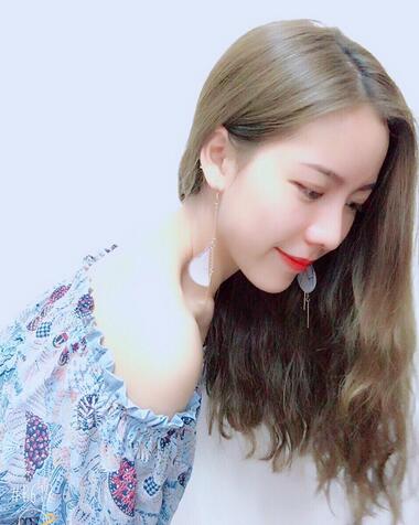 北京藝星王英勇隆鼻案例 隆鼻整形三個月