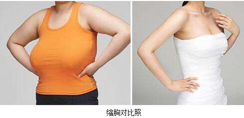 巨乳如何縮??？巨大乳房縮小需要注意什么？