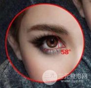 你適合開內(nèi)眼角還是開外眼角呢？