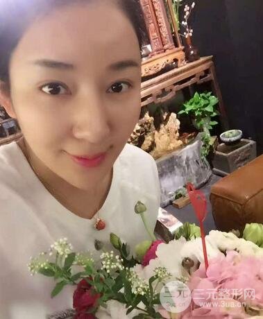 全臉線D圖片 線D恢復(fù)過程圖片