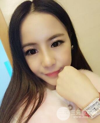 假體隆鼻恢復過程實例 前后果對比