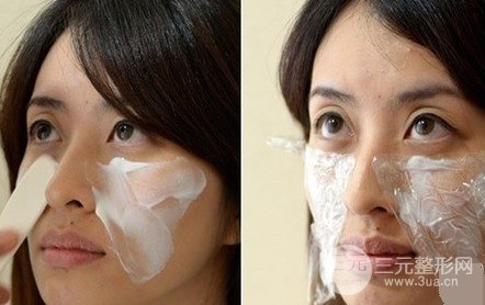 “人未老，皺先行”，注射除皺面部年輕化修復(fù)過程