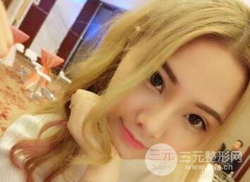 開內(nèi)眼角和三點(diǎn)定位雙眼皮恢復(fù)過程圖片真人案例分享