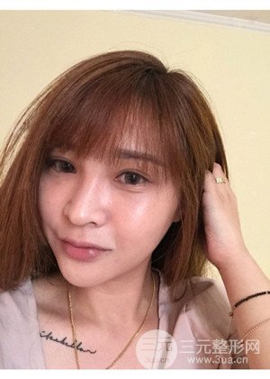 高強(qiáng)度聚焦超聲手術(shù)前后過程以及真實(shí)案例分享——廈門思明安黛美林韻醫(yī)生做的