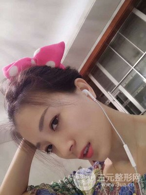 分享我的激光祛眼袋手術(shù)前后過程，廈門思明安黛美林韻醫(yī)生做的