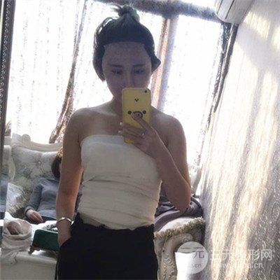 溫州友好醫(yī)院尹建祥自體脂肪隆胸真人案例分享