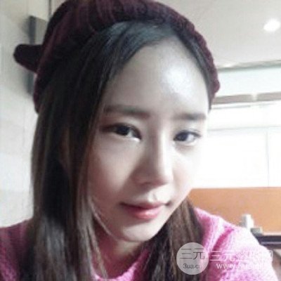 四川美萊牛永敢隆鼻整形三個月果照片分享~