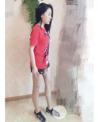 大腿吸脂前后對(duì)比照片，南昌永康王忠干真實(shí)案例分享