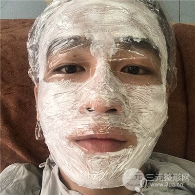 濟(jì)南曹博士魯開化祛痘坑痘印真人案例分享