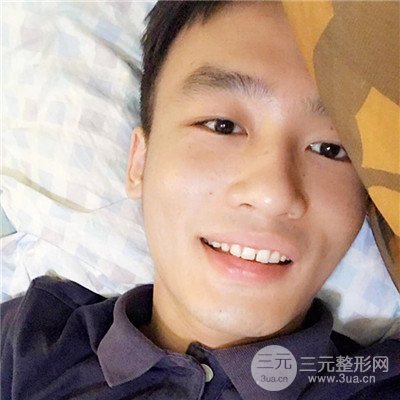 濟(jì)南曹博士魯開化祛痘坑痘印真人案例分享