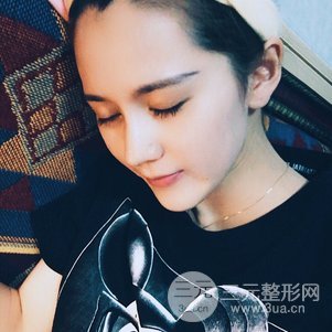 隆鼻整形多少錢 李圣利隆鼻整形案例