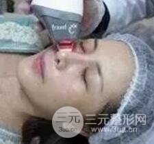 我做了光子嫩膚幾天起而且價格便宜前后對比照片案例