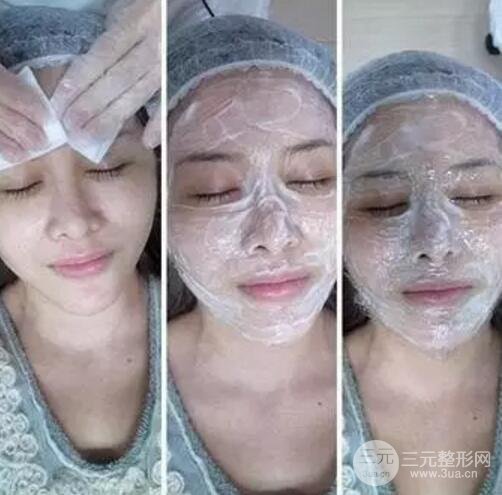 我做了光子嫩膚幾天起而且價格便宜前后對比照片案例