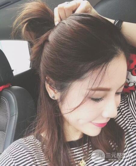 大腿抽脂做臉部脂肪填充 包括太陽(yáng)穴和額頭價(jià)格果分享