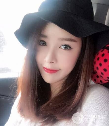 大腿抽脂做臉部脂肪填充 包括太陽(yáng)穴和額頭價(jià)格果分享