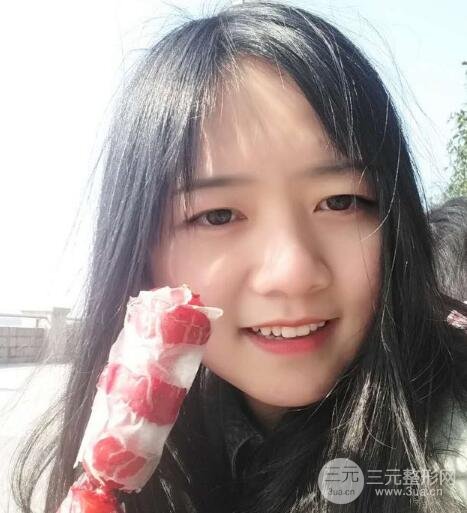 怎樣減掉雙下巴？雙下巴吸脂后個(gè)人經(jīng)歷 價(jià)格略貴但果好