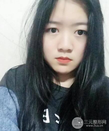 怎樣減掉雙下巴？雙下巴吸脂后個(gè)人經(jīng)歷 價(jià)格略貴但果好