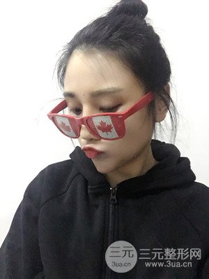 珠海萊茵門診部馬中衛(wèi)隆鼻整形案例分享，并附上前后對比照片~