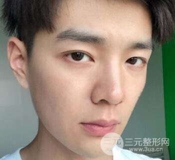 高強度聚焦超聲面b提升術(shù)多少錢?親身經(jīng)歷案例