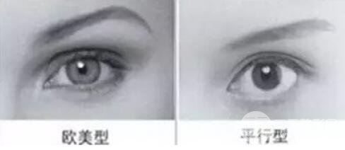 做歐式雙眼皮價(jià)格和需要滿足5個(gè)條件果才好