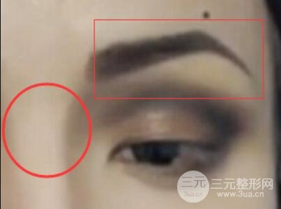 做歐式雙眼皮價(jià)格和需要滿足5個(gè)條件果才好