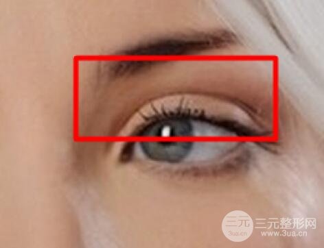 做歐式雙眼皮價(jià)格和需要滿足5個(gè)條件果才好