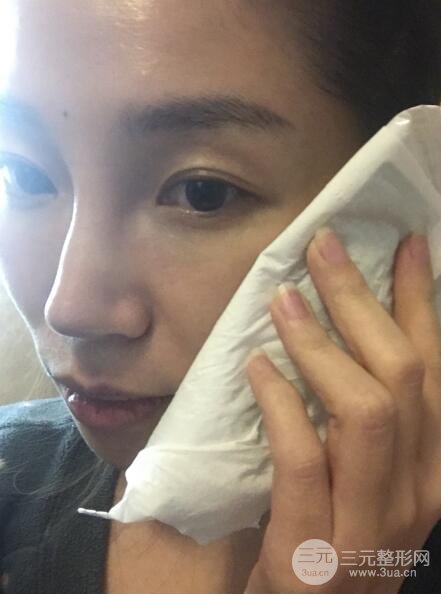 面b提升術(shù)多少錢?價格和案例分享