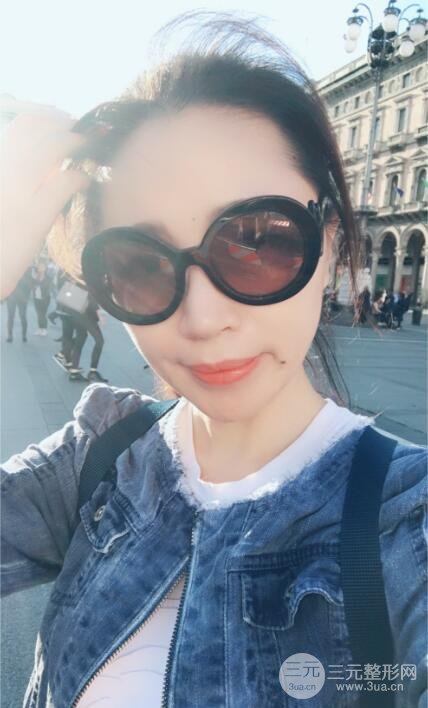 面b提升術(shù)多少錢?價格和案例分享