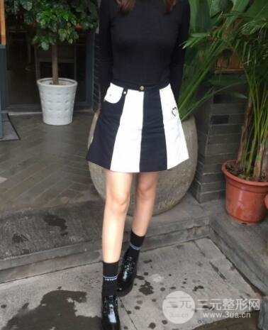 腹部抽脂價(jià)格和恢復(fù)案例