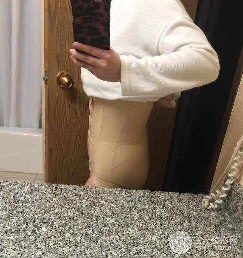 腹部抽脂價(jià)格和恢復(fù)案例