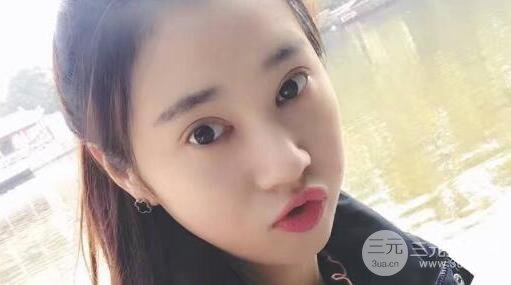 切開(kāi)雙眼皮+開(kāi)內(nèi)眼角案例