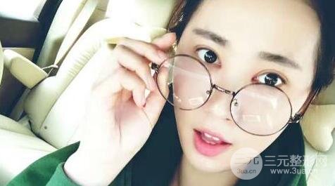 切開(kāi)雙眼皮+開(kāi)內(nèi)眼角案例