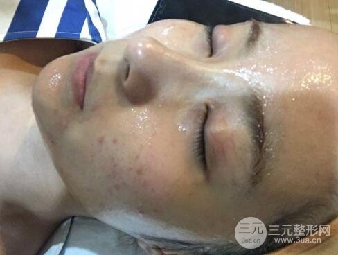 注射水光補(bǔ)水價(jià)格和案例圖片