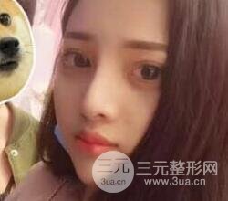 上海鼻子整形專家、價格和案例