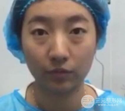 微創(chuàng)內(nèi)切去眼袋手術(shù)價(jià)格和恢復(fù)過程圖案例