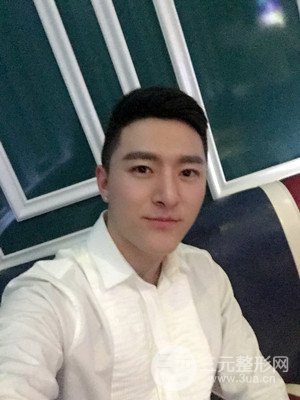 玻尿酸豐額頭手術(shù)前后過(guò)程以及真實(shí)案例分享——武漢美都朱紅霞醫(yī)生做的