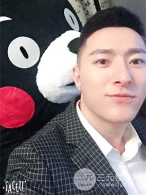 玻尿酸豐額頭手術(shù)前后過(guò)程以及真實(shí)案例分享——武漢美都朱紅霞醫(yī)生做的