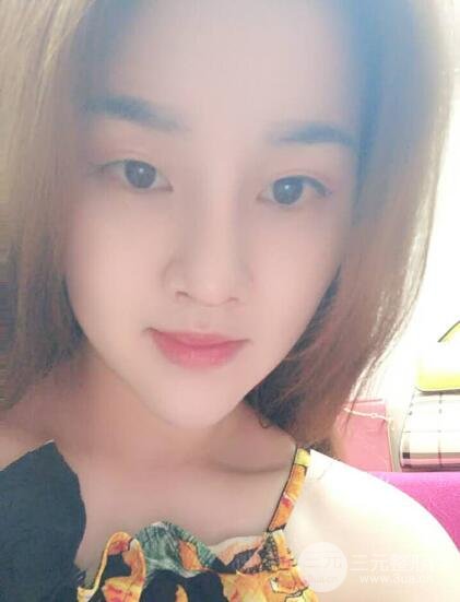 蒜頭鼻整形價(jià)格和對(duì)比照片案例