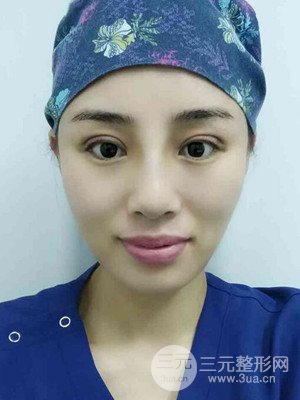 青?？等A馬晶醫(yī)生給我做的硅膠假體隆鼻+雙眼皮手術(shù)，分享一下前后對(duì)比圖
