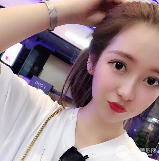 長(zhǎng)得太著急是怎樣一種體驗(yàn)？妹子血淚分享自體脂肪填充詳細(xì)部年輕化經(jīng)驗(yàn)