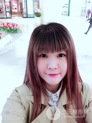 做了自體脂肪填充全臉日記分享——汕頭伊麗莎白孫杰醫(yī)生做的