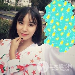 雙眼皮+開內(nèi)眼角手術(shù)前后對(duì)比圖片，真實(shí)案例