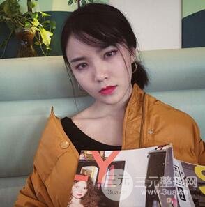 雙眼皮+開內(nèi)眼角手術(shù)前后對(duì)比圖片，真實(shí)案例